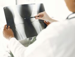 5 Kiat Cegah Osteoporosis: Tulang Tetap Kuat!