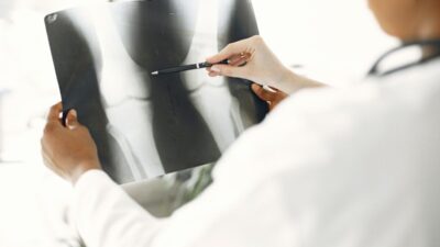 5 Kiat Cegah Osteoporosis: Tulang Tetap Kuat!
